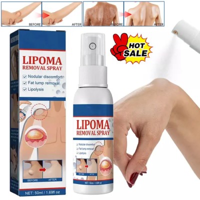 South Moon™ Lipoma Removal Spray